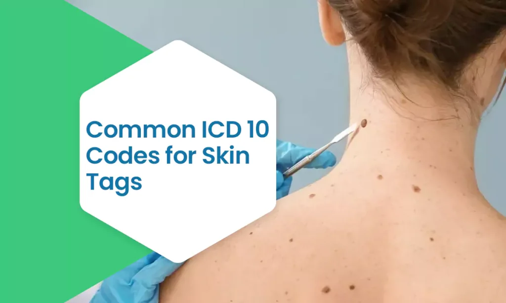 common icd 10 codes for skin tags