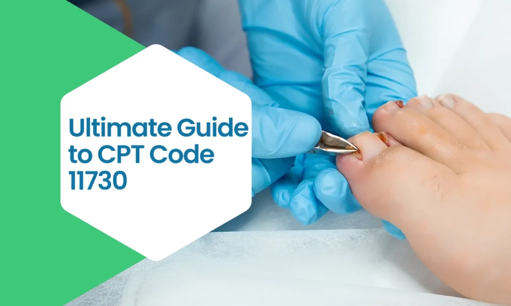 Ultimate Guide to CPT Code 11730
